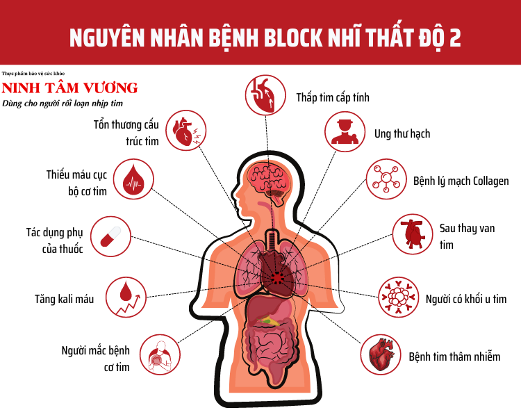 Nguyen-nhan-gay-block-nhi-that-do-2